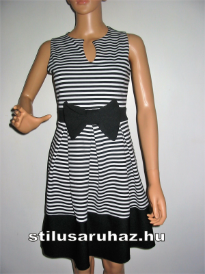 Csíkos nyári ruha Quiz